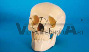 Skull, with holder, fractured, mandible